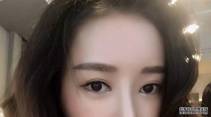 健丽医美激光去眼袋案例分享